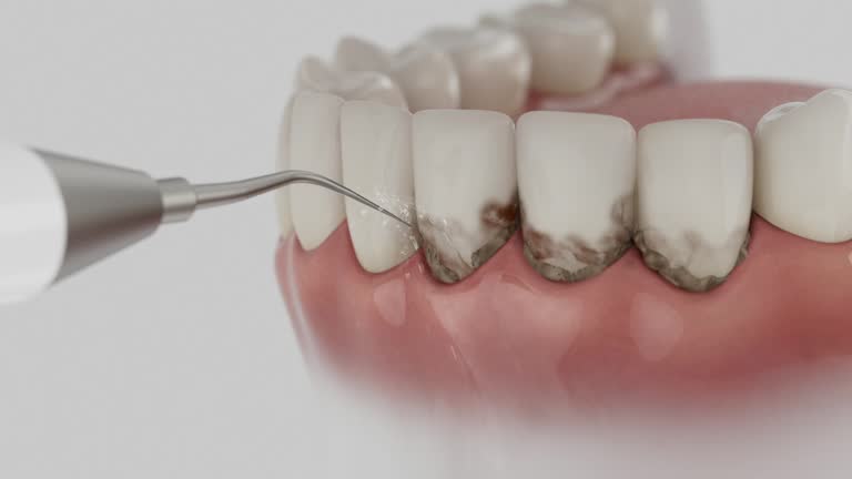 Trusted Emergency Dentist service in Lexington, TN - Dentist Open Now